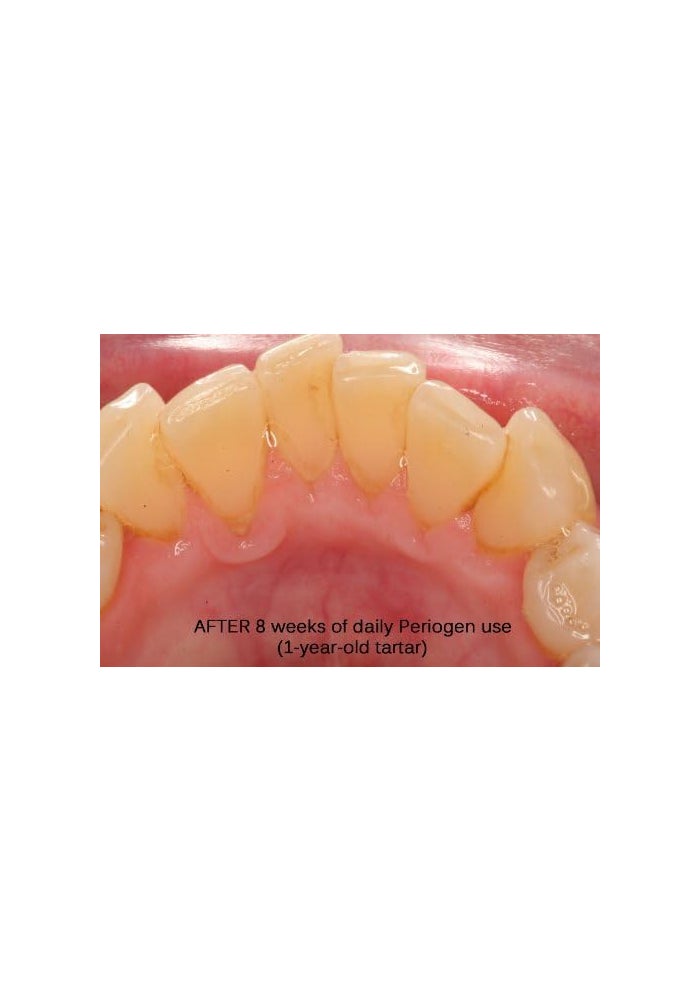 Periogen Complete Oral Health Rinse - 3 Pack for Dental Tartar Reduction - Image 5